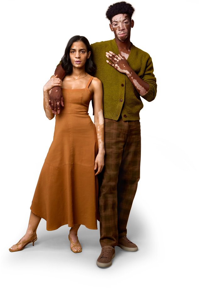 Man and woman standing with vitiligo
