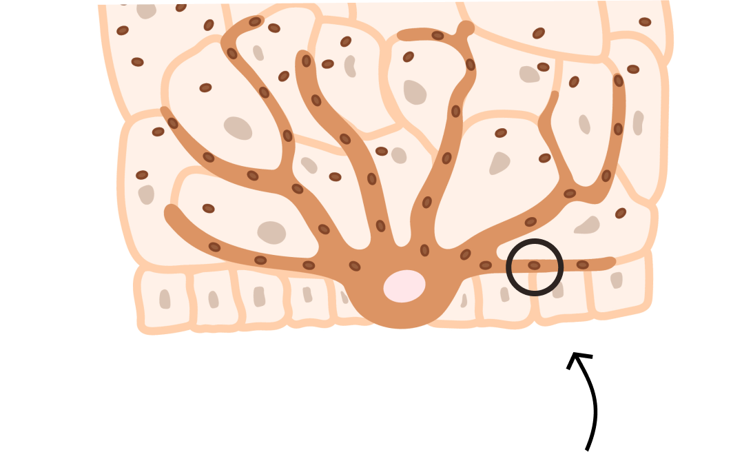 Illustration of a melanocyte in the skin transferring melanin pigment to surrounding skin cells, showing how pigment normally spreads — the process that stops in vitiligo.