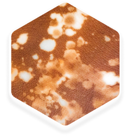 Close-up view of trichrome lesions on the skin, showing distinct patches of white and brown discoloration.